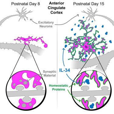 Autisms immune connection neuron-derived IL-34 and microglia.jpg