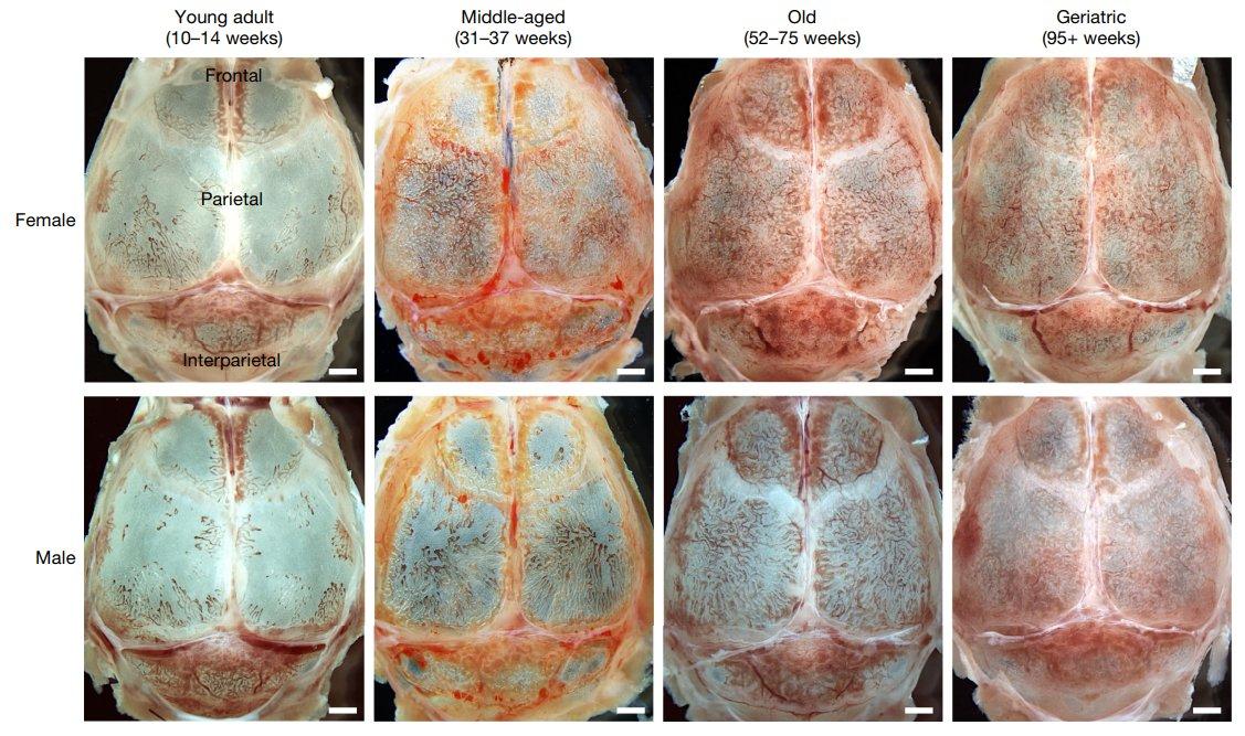 Skull Bone Marrow Sustains Blood Production in Old Mice.jpg